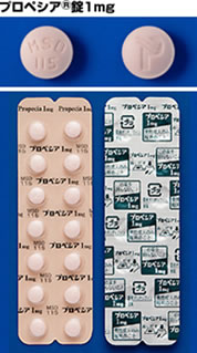 ＡＧＡ治療薬プロペシア錠剤イメージ02