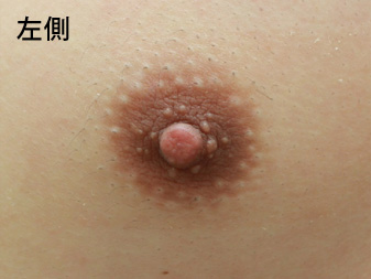 症例