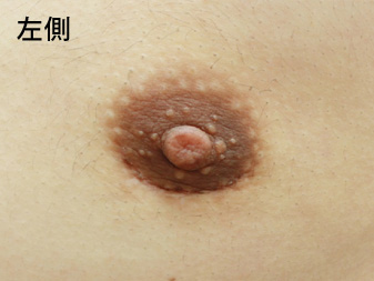 症例