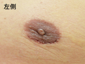 症例