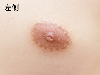 症例