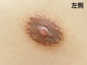 症例