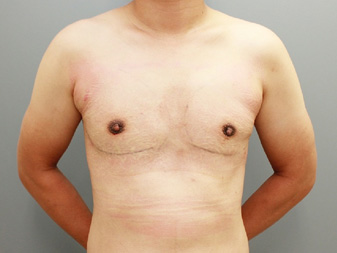 症例