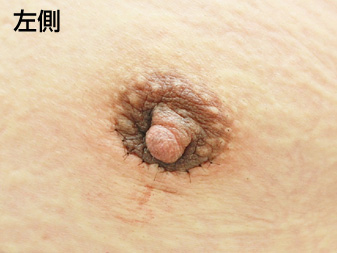 症例