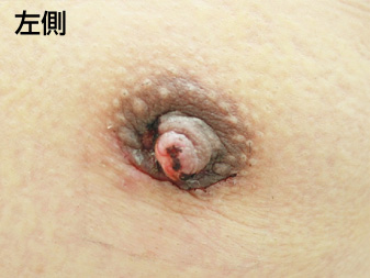 症例