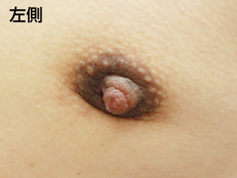 症例