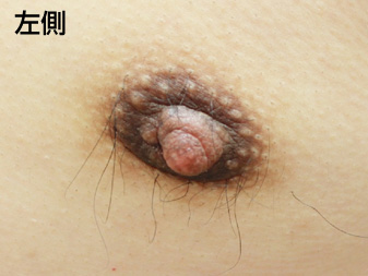 症例