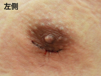 症例