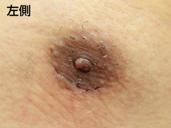 症例